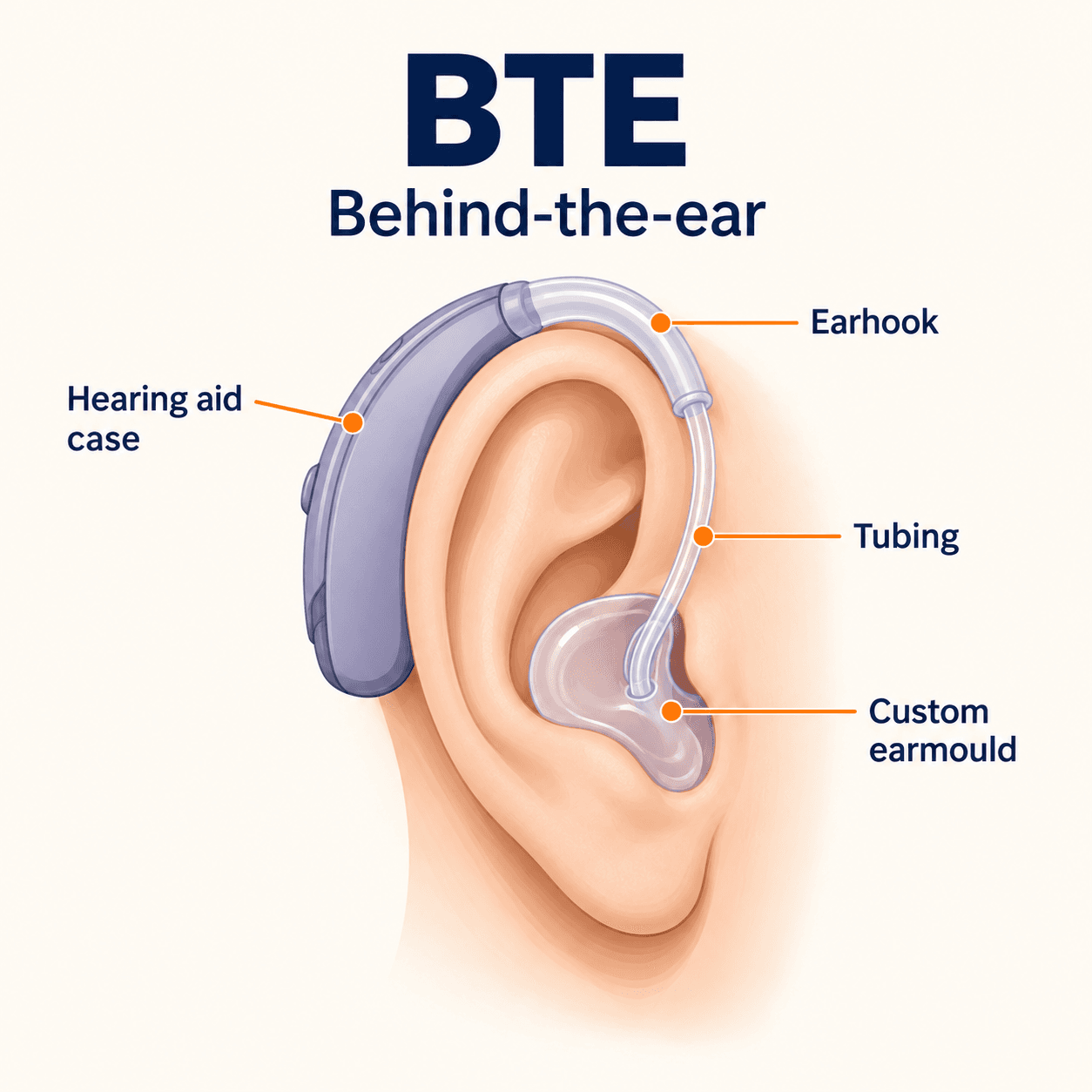 Educational diagram of a behind-the-ear hearing aid with an earhook, tubing and custom earmould