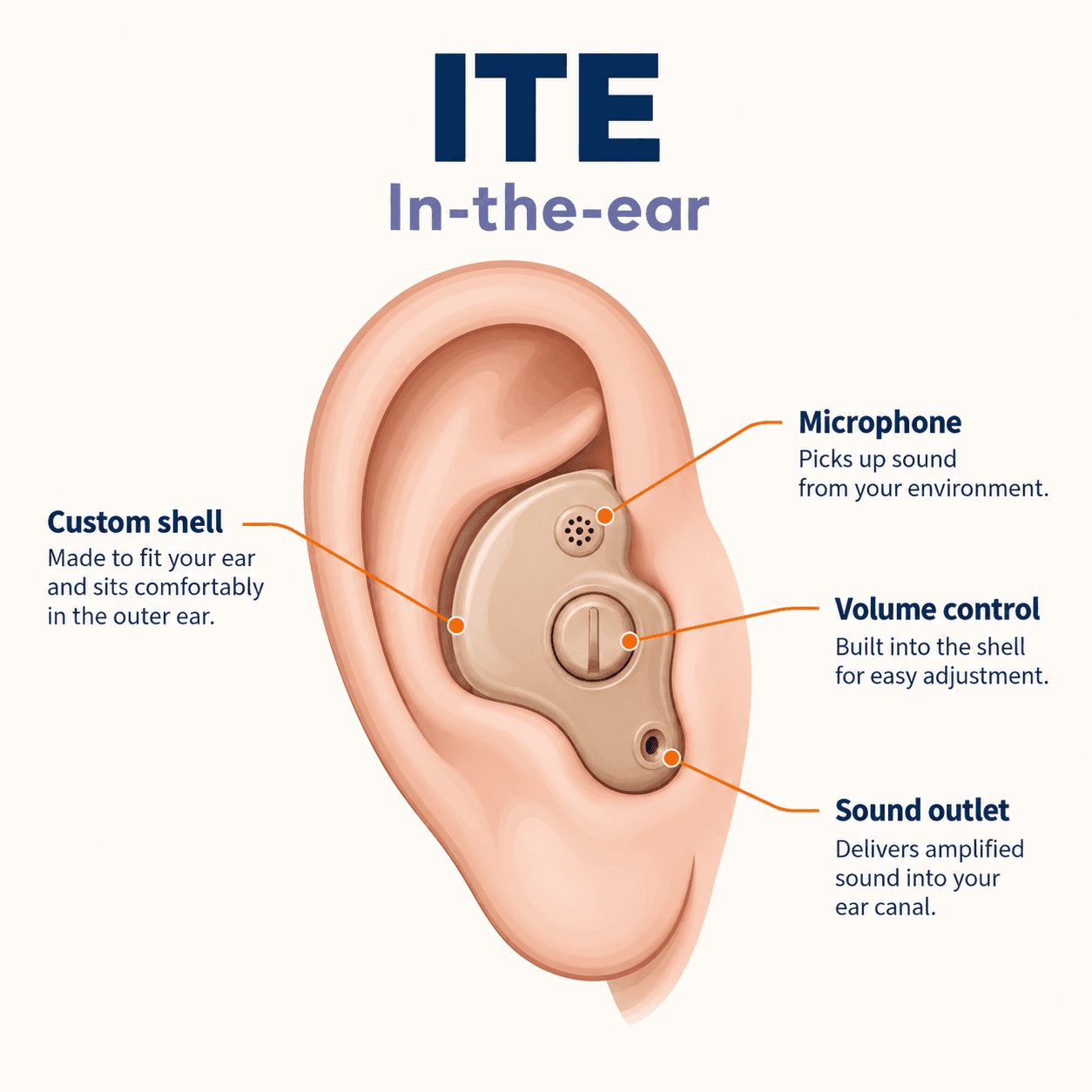 Educational diagram of an in-the-ear hearing aid with a custom shell, microphone and volume control