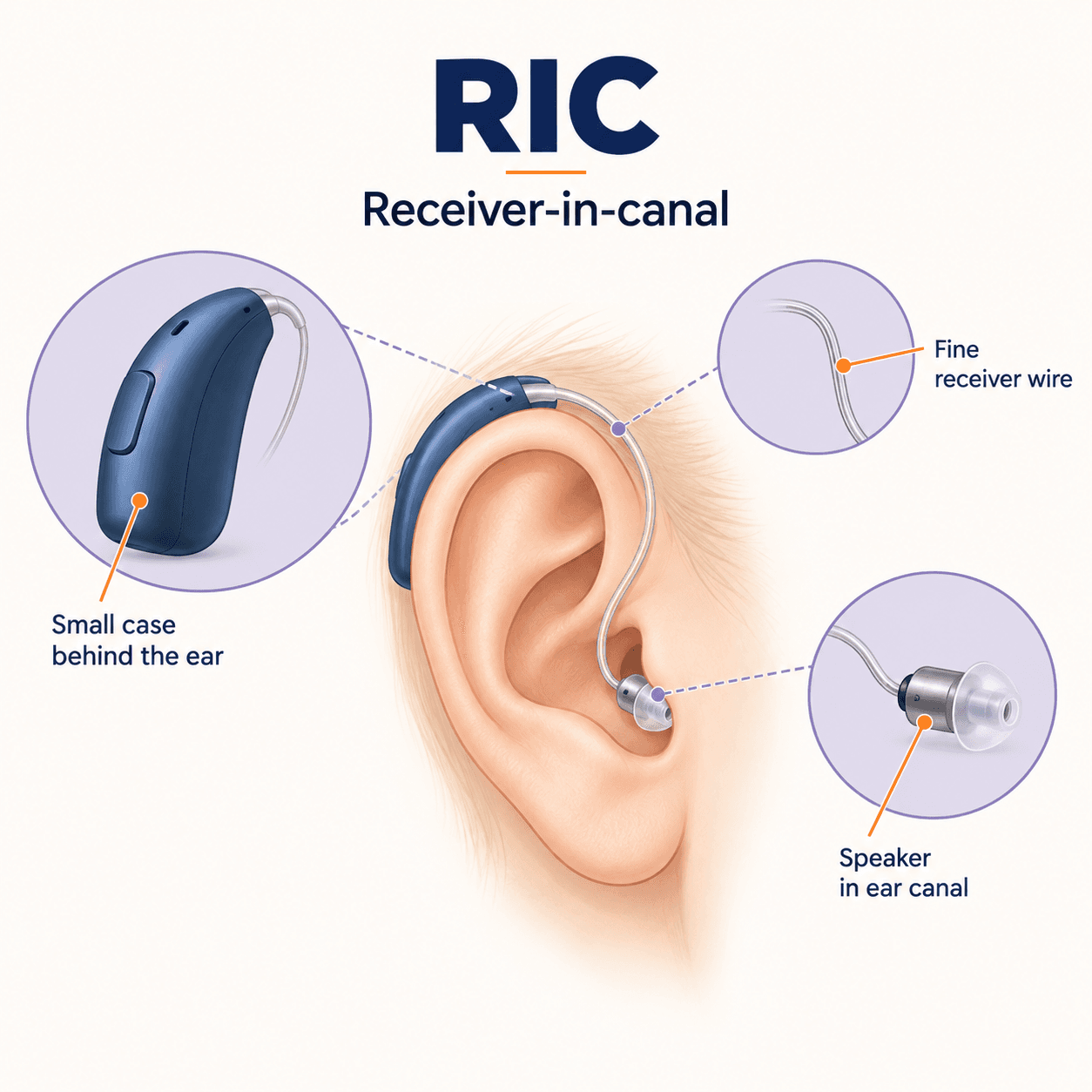 Educational diagram of a receiver-in-canal hearing aid with a case behind the ear, fine receiver wire and speaker in the ear canal
